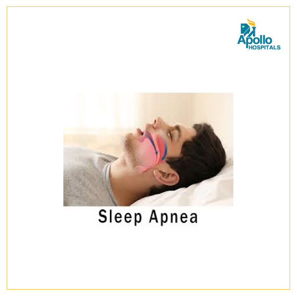 What is sleep apnea and how do you treat it?