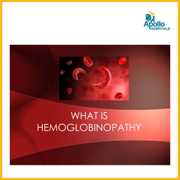 Hemoglobinopathies: A comprehensive overview