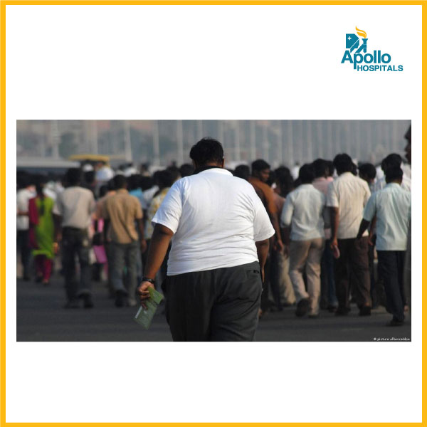 Obesity on the rise among young working individuals in India