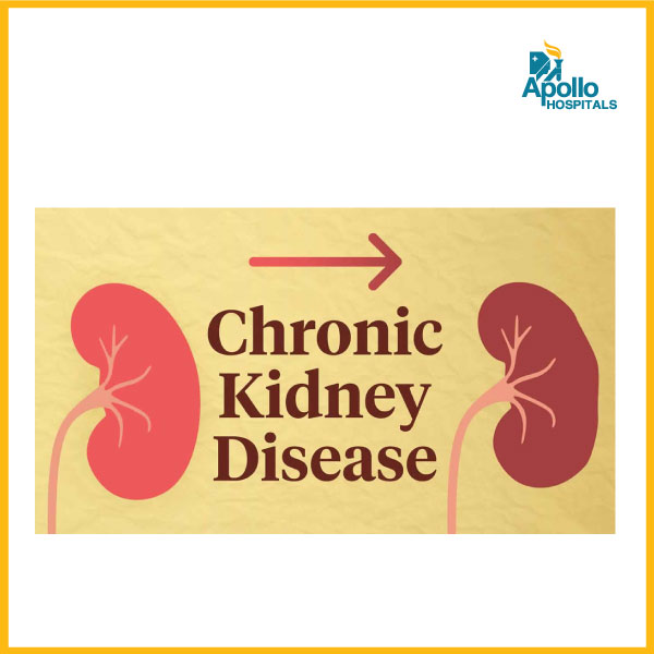 Chronic Kidney Disease: Recognizing the silent threat