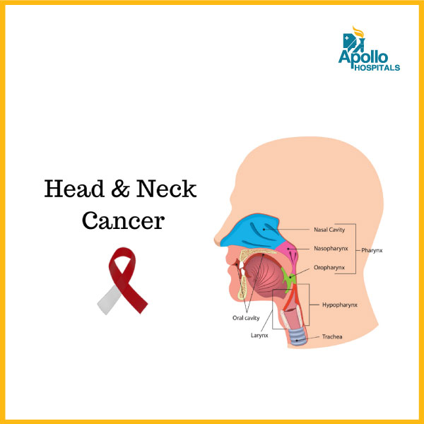 What is the main cause of neck cancer?