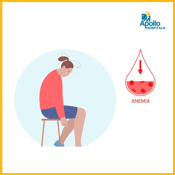 The ill-effects of anemia in women - Apollo Hospital - Best